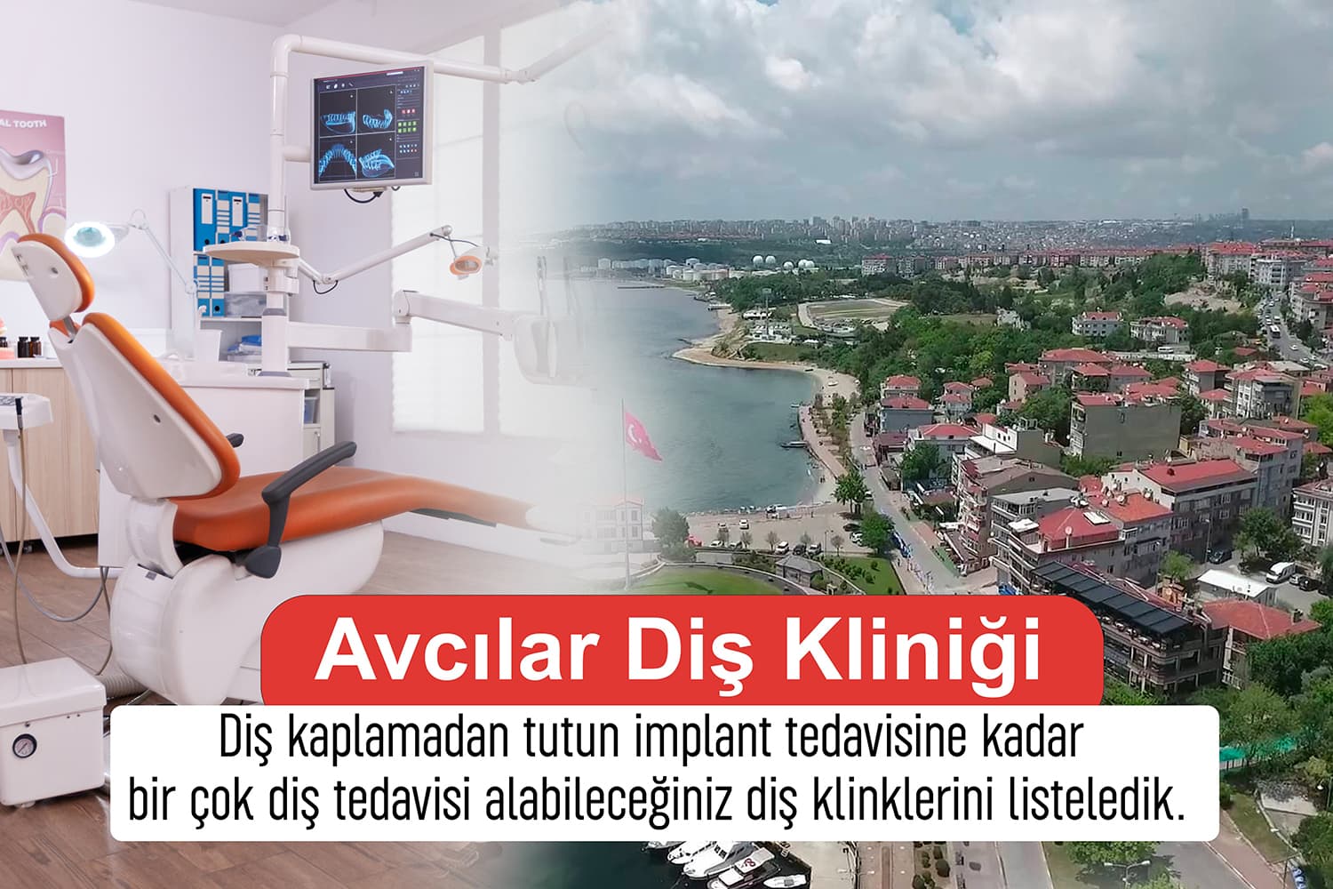 Diş Teli Tedavisi Yapan Avcılar Dişçi